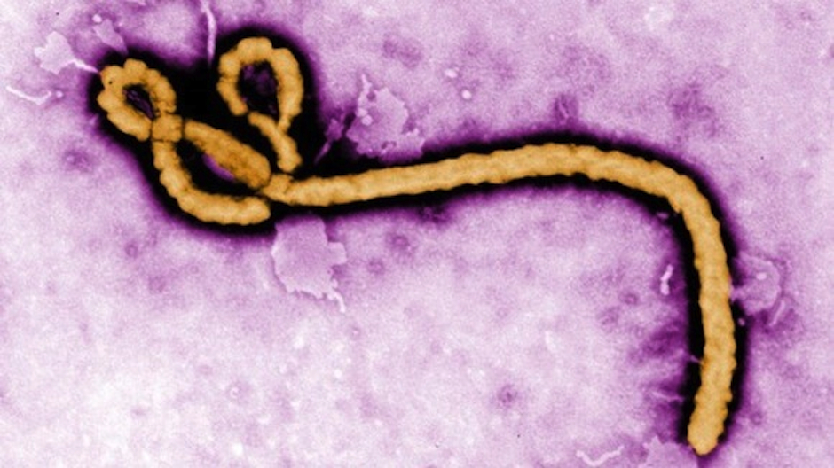 ebola-vaccine-philadelphia-matthias-schnell