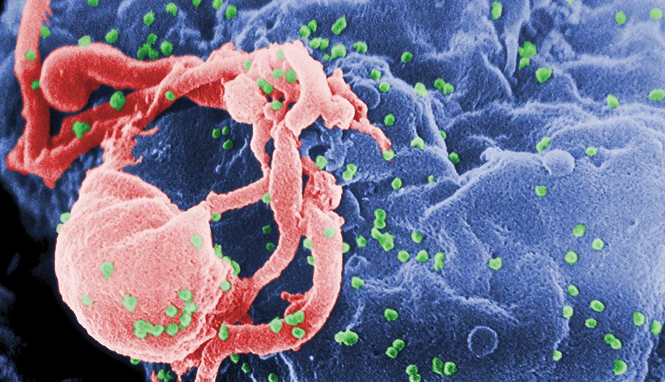 HIV particles bud from a white blood cell. Photograph from the CDC