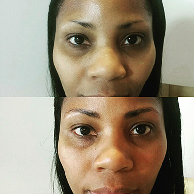Microblading Before and After2