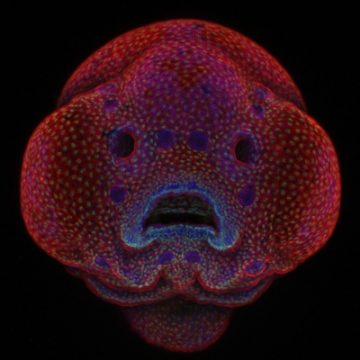 First place in the 2016 Photomicrography Competition went to Dr. Oscar Ruiz for his four-day-old zebrafish embryo photo.