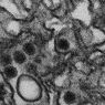 Zika virus micrograph