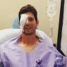 Matt Imhof - instagram - eye injury