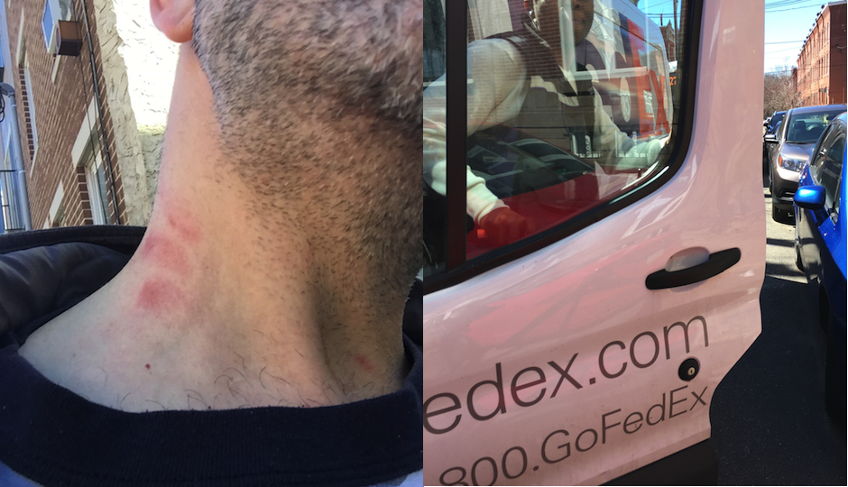 Left: Northern Liberties resident Ned Sonstein says the FedEx driver strangled him, leaving these marks. Right: Sonstein took this photo of his alleged attacker.