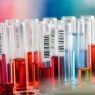 at-home-dna-tests