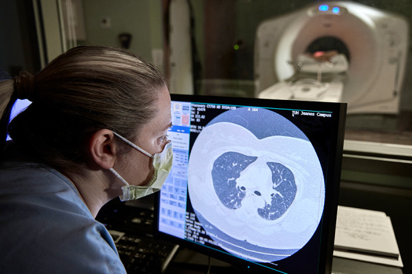 How This Philly Hospital Is Optimizing Lung Cancer Screenings For Patients